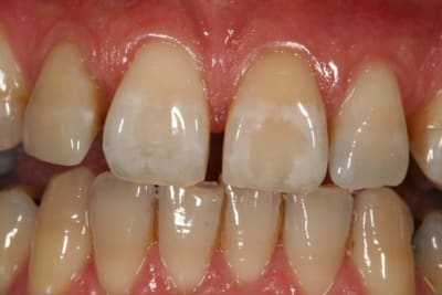 Apr s mhz5av - Eugenol