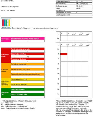 Apres laser k4d50x - Eugenol