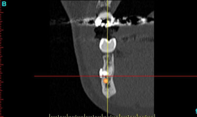 Ar cross section35 mobqdj - Eugenol