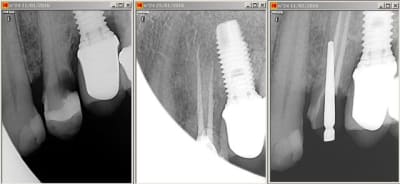 Atchoum iw33dp - Eugenol