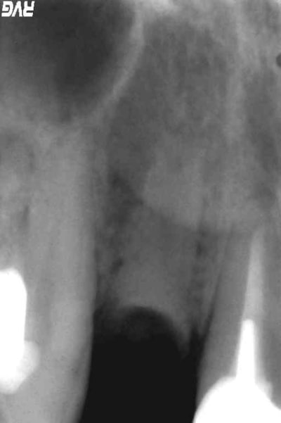 Augmentat jc59zt - Eugenol