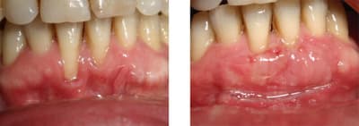 Av ap 15j v8tl6s - Eugenol