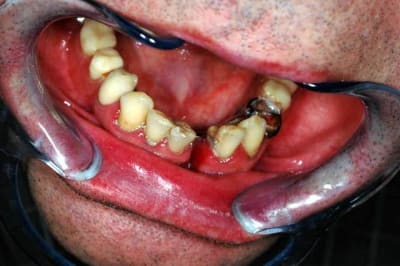 Avant03 aqddpz - Eugenol