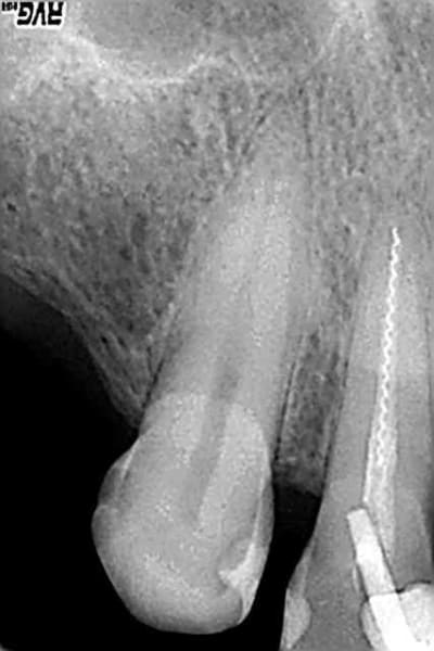 Avant 2007 aqourx - Eugenol