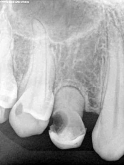 Avant xq3yaa - Eugenol