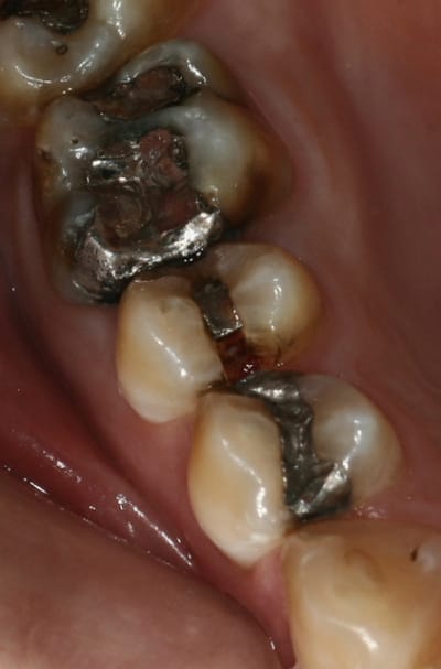 Avant yzd8ux - Eugenol