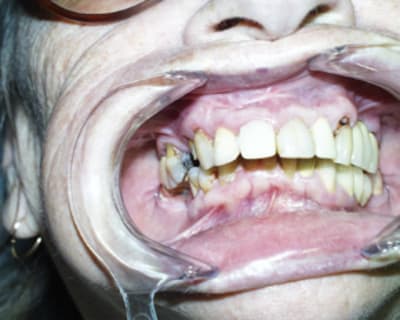 Aya5 ngfbah - Eugenol