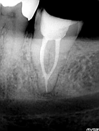 Azeiteiro  lopes  q3swyz - Eugenol