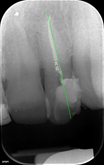 Bérouane igcaka - Eugenol