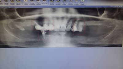 B9vogxzfdsk0m2lbwhrd - Eugenol