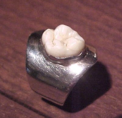 Bague dent ydwl9d - Eugenol