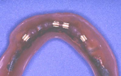 Barre bas02 cnnq1f - Eugenol
