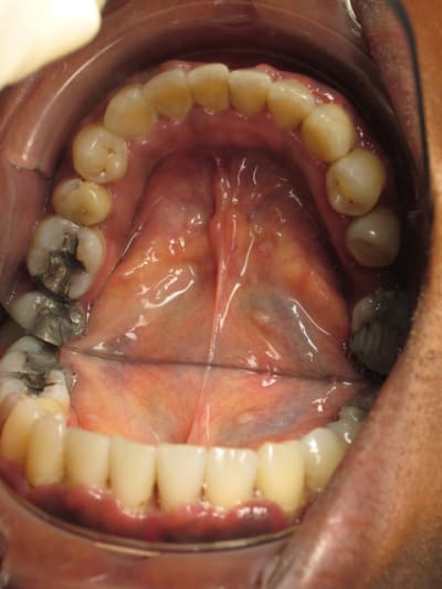 Bas l5icua - Eugenol