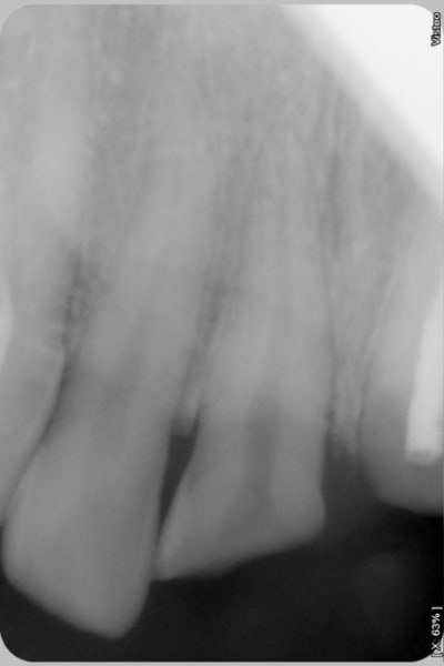 Bbb zlzscz - Eugenol