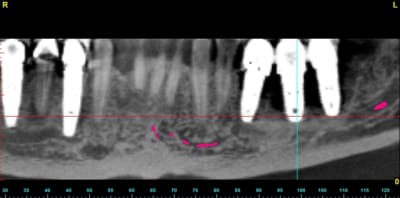Bernard panoramic l8hei0 - Eugenol
