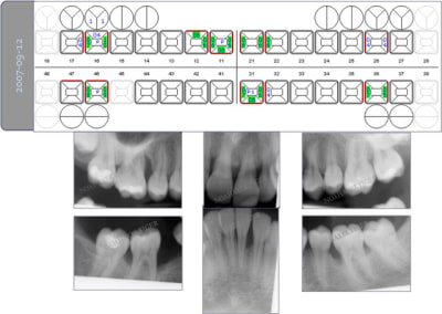 Bilan initial nhvmno - Eugenol