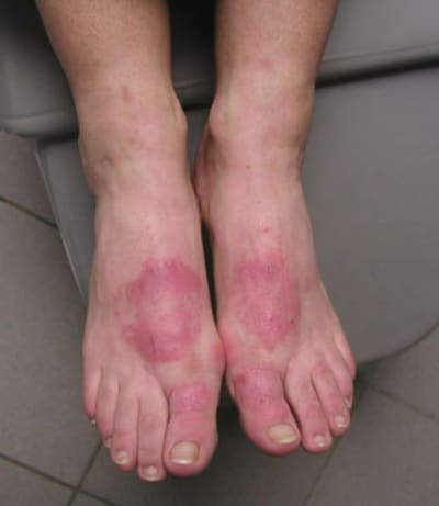 Bn1 omsx6p - Eugenol