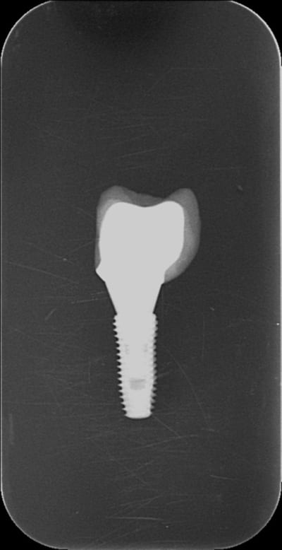 Bon r7e1mq - Eugenol