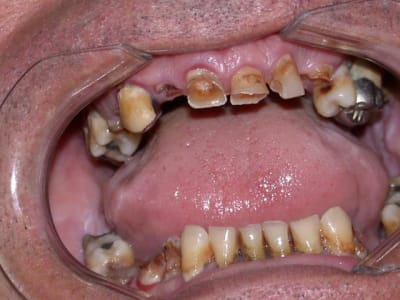 Bourd z6fkgu - Eugenol