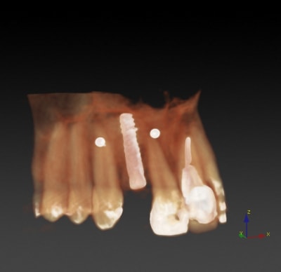 Bourdon 3d smbqqr - Eugenol