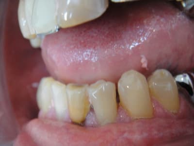 Bridge colle 003 kypdzy - Eugenol