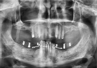 Bruxime dv nmbvud - Eugenol