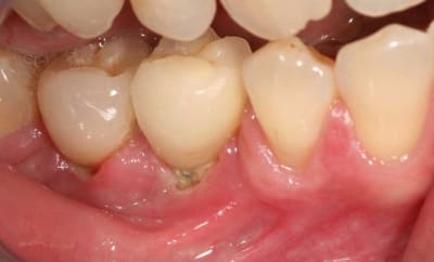 C estmalbarr  oacxif - Eugenol