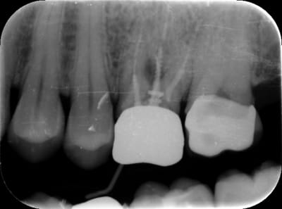 Cab3 hcll8h - Eugenol