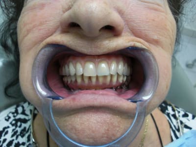 Carpinelliface pzdf6b - Eugenol