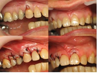 Cas1 nqq1n3 - Eugenol