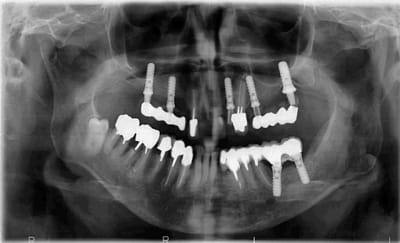 Cas 1 q2myqt - Eugenol