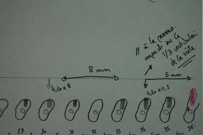 Cas 2  custom  tectjz - Eugenol