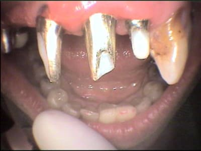 Cas 3 1 en3hrz - Eugenol
