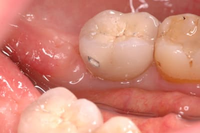 Cas 4 7 cyq8ng - Eugenol