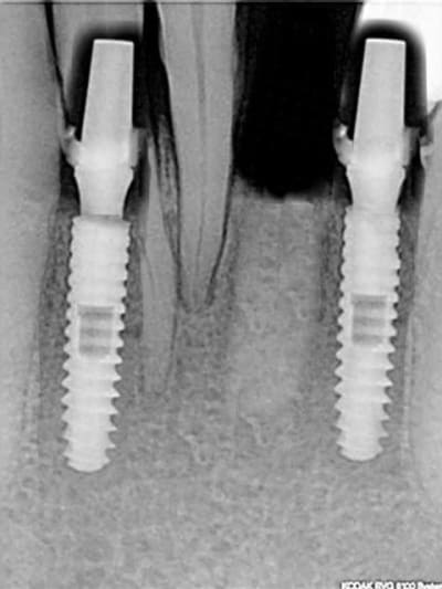 Cas axiom 2 - Eugenol