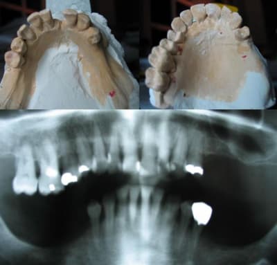 Cas posturo  3 omd4a4 - Eugenol