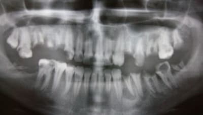 Cata h1fgvo - Eugenol