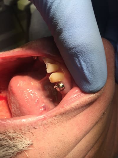 Ccadtnfrfuclz6lltmma - Eugenol