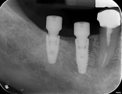 Ccommso9cwlrke2ndo4y - Eugenol