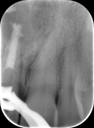 Cd19012015 194735 z0awer - Eugenol