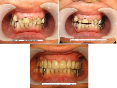 Centrage des milieux yxywsy - Eugenol