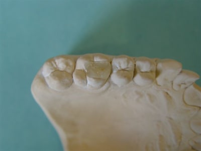 Cerec11 upehkj - Eugenol