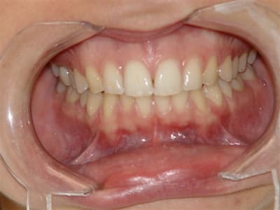 Cerec sur 16 vue globale le46ye - Eugenol