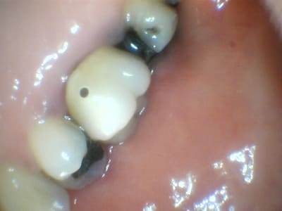 Cgoo52kpc5orcceulq79 - Eugenol