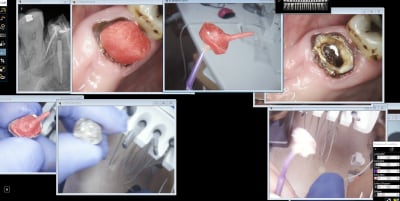 Charles 4 i5zot5 - Eugenol