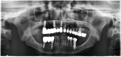 Cllt8mo6w9qebffvqxj0210a9t7r - Eugenol