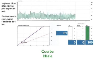 Coherence2 fxtrwp - Eugenol