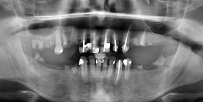 Coiffe2 zazdgv - Eugenol