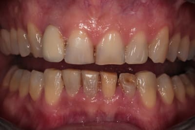 Compo 11 aw14t3 - Eugenol