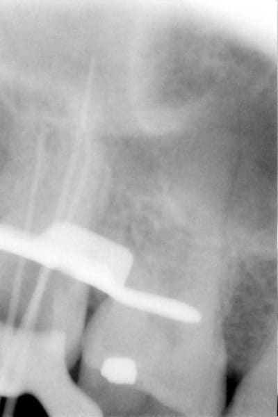 Cones 2002 npmcmg - Eugenol